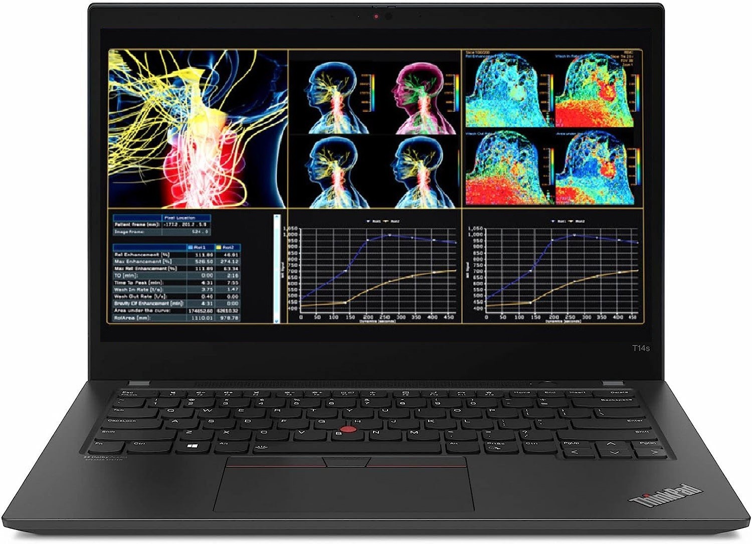 14″ FHD Lenovo ThinkPad Laptop PC: Ryzen 5 PRO 4650U (16GB RAM, 512GB NVME SSD)