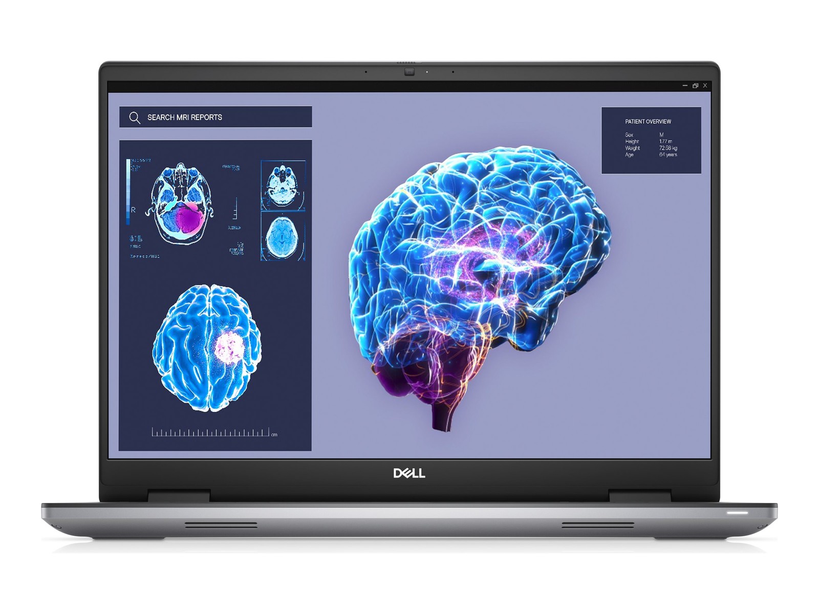 Dell Precision 7680 4K UHD Touch i7-13850HX 64GB RAM 1TB SSD RTX 2000 Ada 8GB