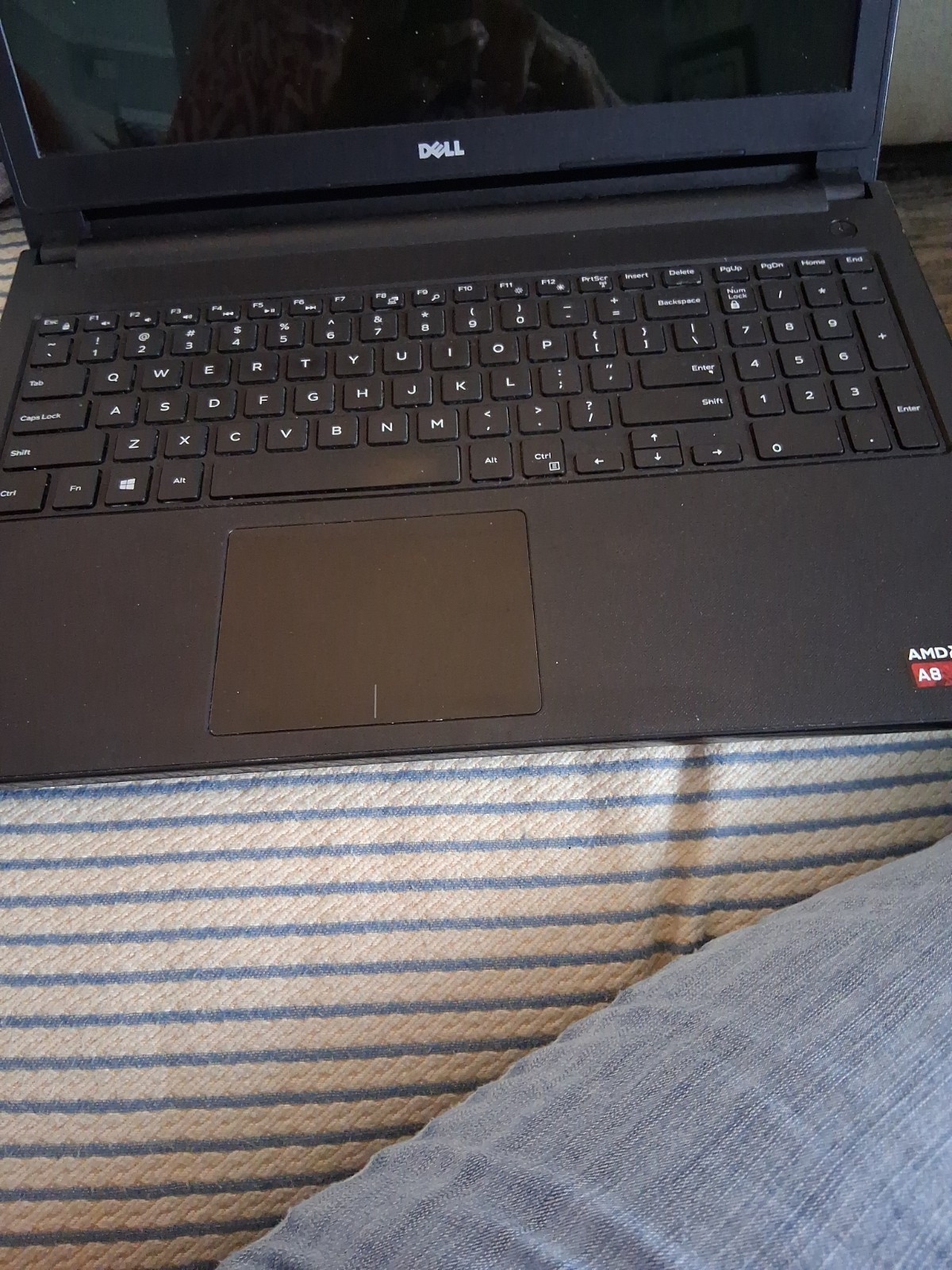 Dell Inspiron 15-5555 AMD A8 for Parts or Repair