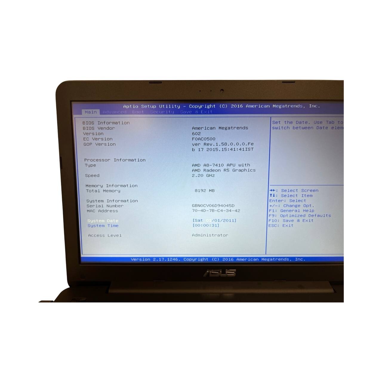 ASUS X555Y Laptop w/ AMD A8-7410 R5 Graphics 8 GB | No HDD / BATT / Charger