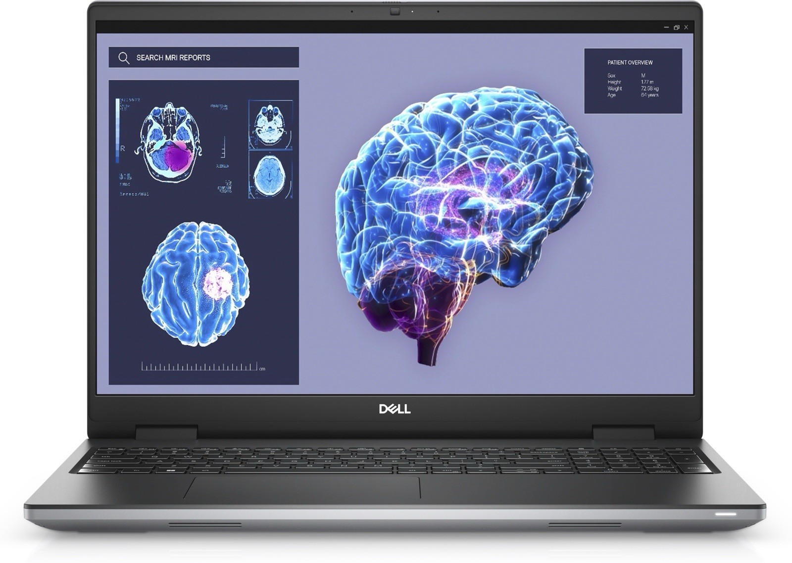 Dell Precision 7680 16″ i9-13950HX 64GB 1TB SSD RTX 2000 Ada W11 Pro