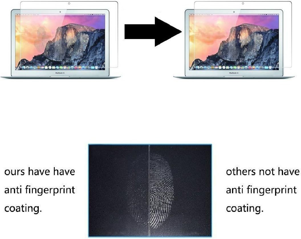 Zshion Laptop Screen Protector for MacBook 12 Inch Retina, Full Coverage Tempere