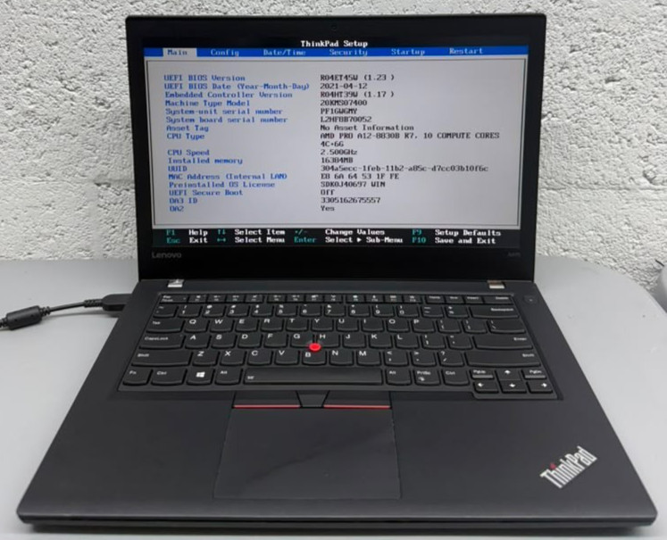Lenovo ThinkPad A475 Untested Minimal Wear No Battery