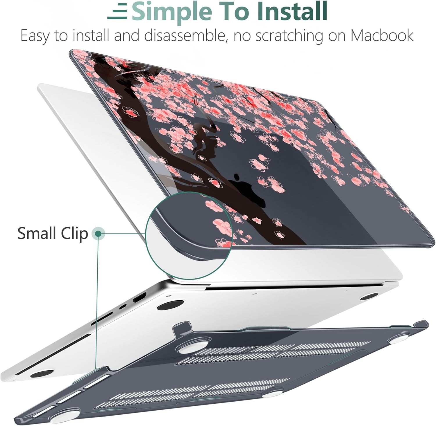 Case for MacBook Pro 14 Inch (2026-2021 Release, M5 M4 M3 M2 M1 Pro/Max Chip)