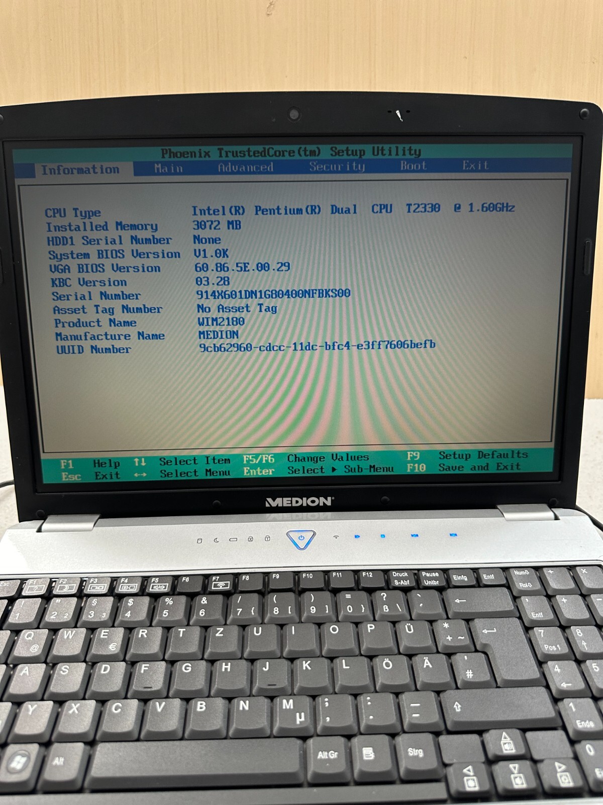 Medion Akoya MD96630 WIM2180 15.4″ Laptop Intel Core Duo T2330 3GB RAM No HDD