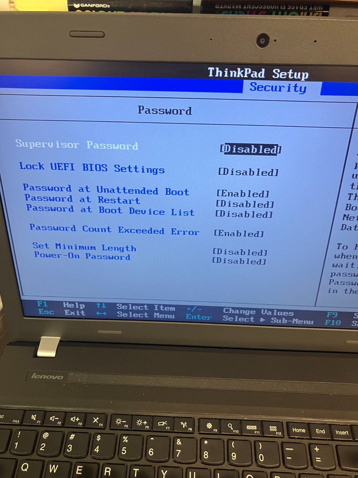 Lenovo ThinkPad E560 15″ Intel Core i5-6200U 2GB RAM NO HD FOR PARTS
