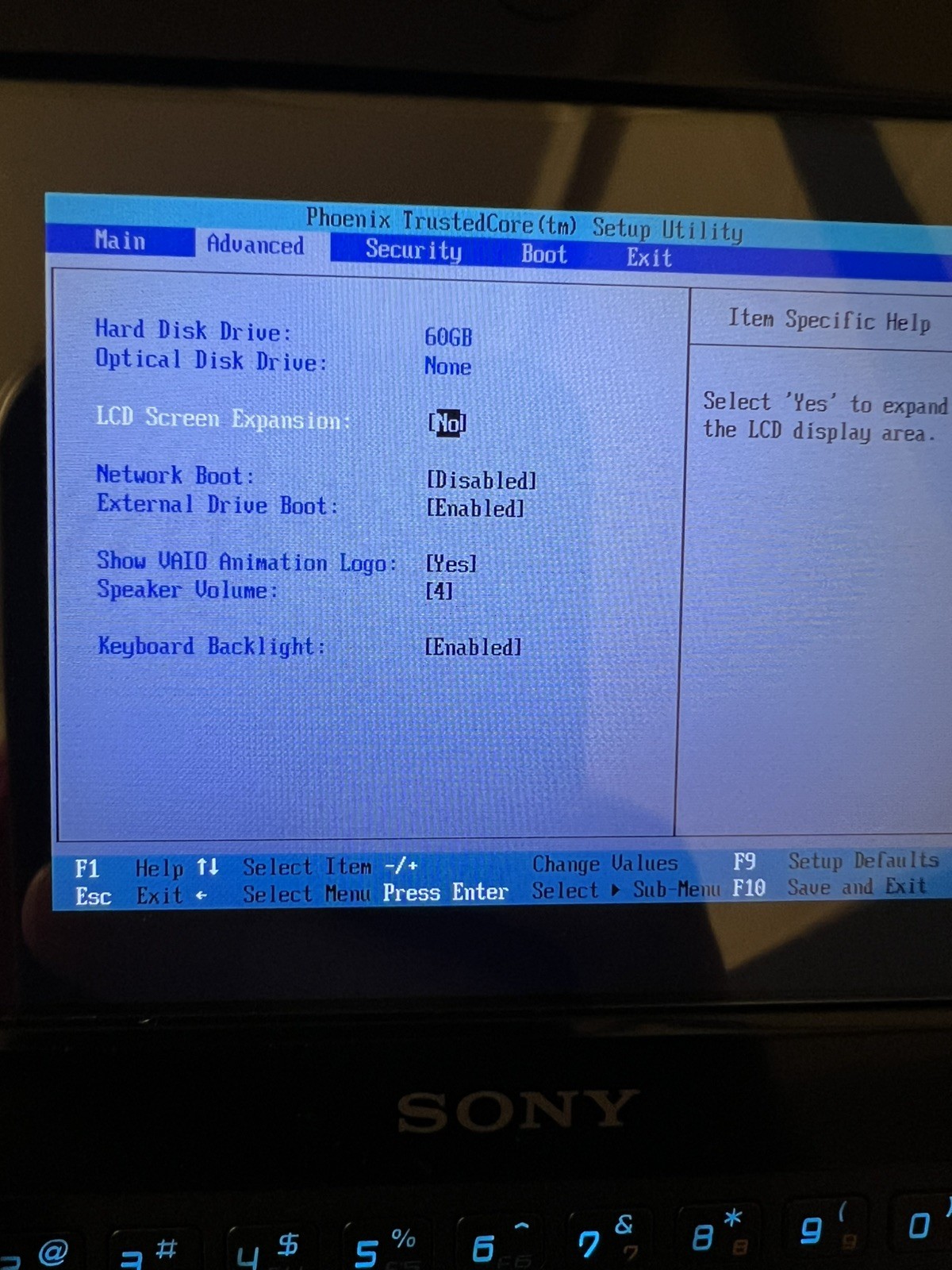 Sony Vaio VGN UX90S Micro PC UMPC – Black, Japan model, Full Accessory Bundle
