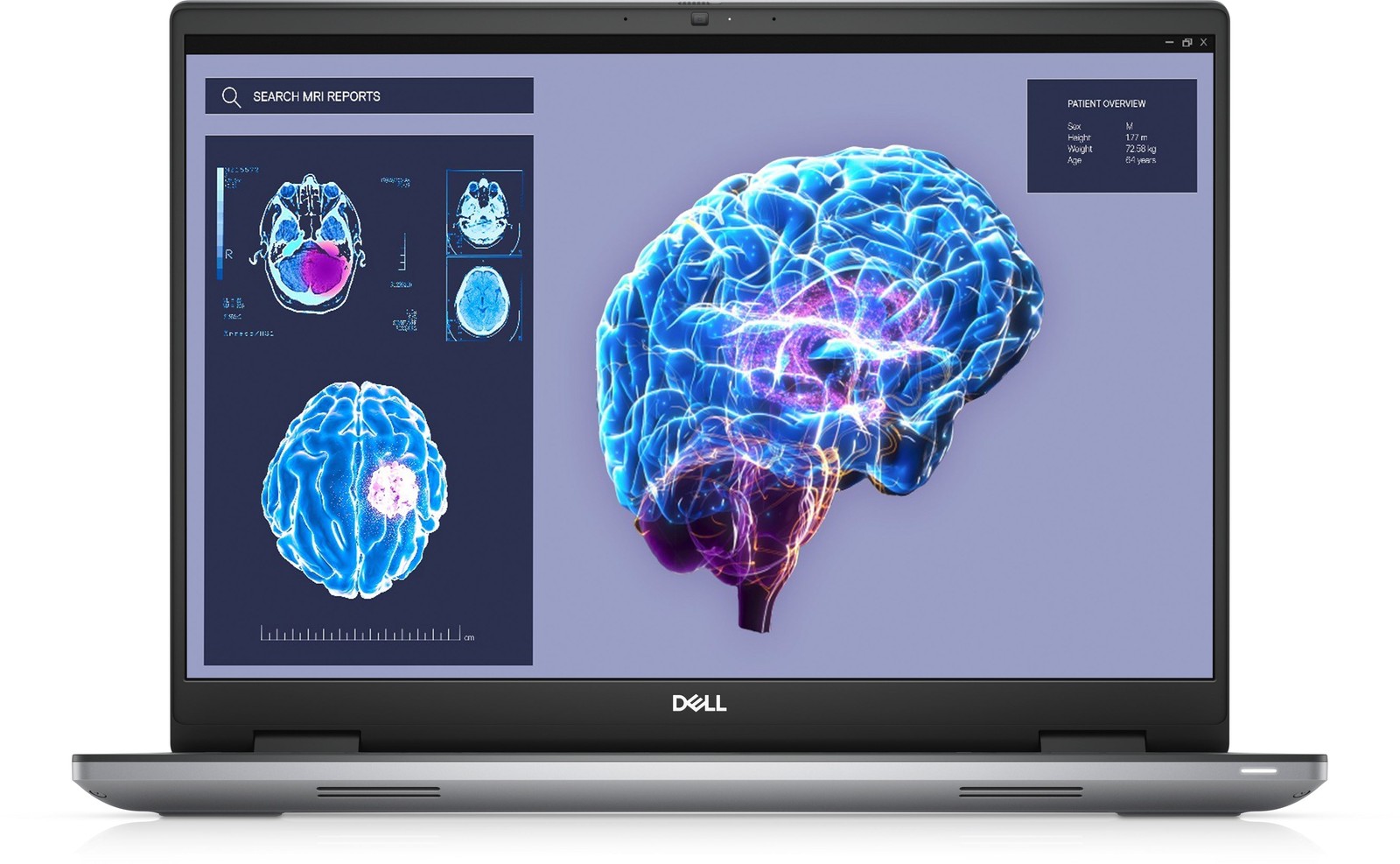 Dell Precision 7680 16″ Workstation, Intel i9, 64GB RAM, 1TB SSD,NVIDIA RTX 2000